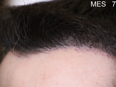 8bGeL5.jpg