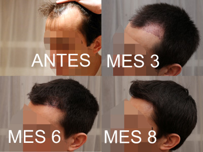 IZQUIERDA 3 6 8 meses