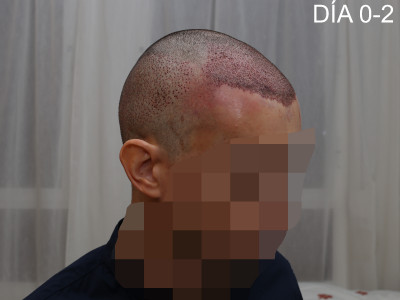 dnah5.jpg