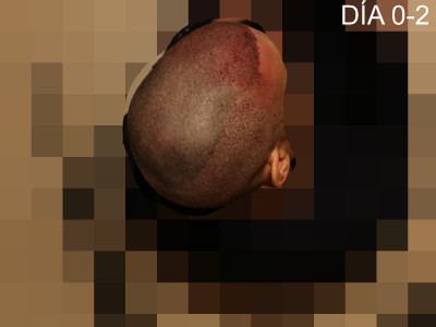 dnbKo.jpg